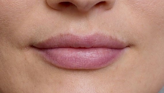 Lèvres