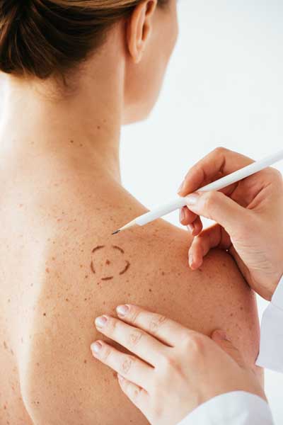 Chirurgie reconstructive