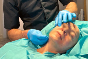 L'Endolift® Chirurgical (Lipo-Endolift)
